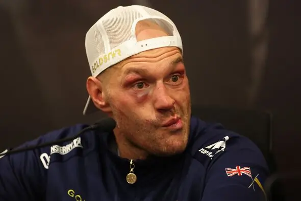 Tyson Fury